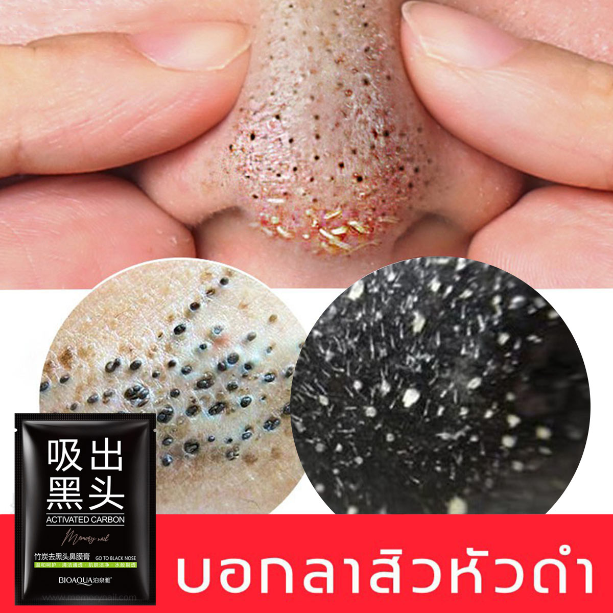 ( มาส์กสิว ซอง BIOAOUA ) บอกลาสิวหัวดดำ เมื่อใช้ มาส์กชาโคล มาร์คลอกสิว ลอกสิวเสี้ยน