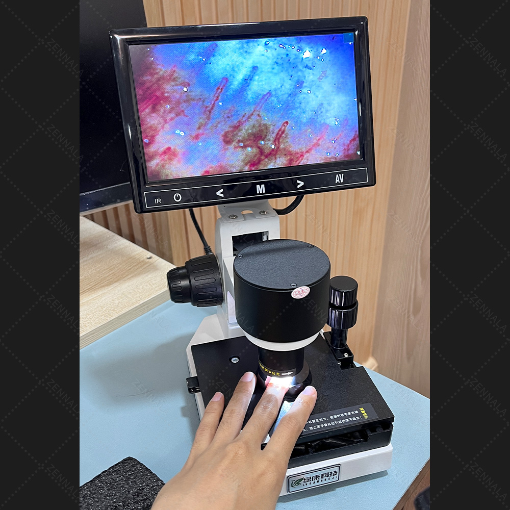 กล้องจุลทรรศน์จุลภาค 480x หน้าจอ LCD 7 นิ้ว สำหรับส่องเส้นเลือดฝอยเล็บ Nailfold Capillaroscopy