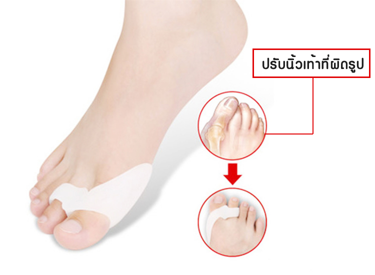 ซิลิโคนคั่นนิ้วเท้าแบบสวม (นิ้วโป้ง/นิ้วชี้/กลาง) 2รู ลดการเสียดสีในการเดิน (x3คู่)
