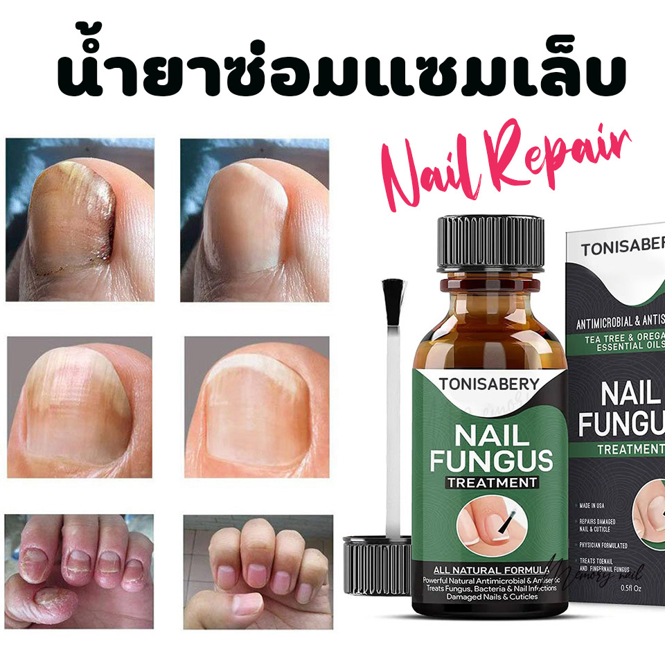 ( TO-04 เขียวใหญ่ 30ml ) ฆ่าเชื้อราที่เล็บ TONISABERY ซรั่มรักษาเล็บ ซ่อมเล็บที่ชำรุด เชื้อราเล็บ ครีมบำรุงเล็บ น้ำยารักษาเชื้อรา ฆ่าเชื้อราเล็บ