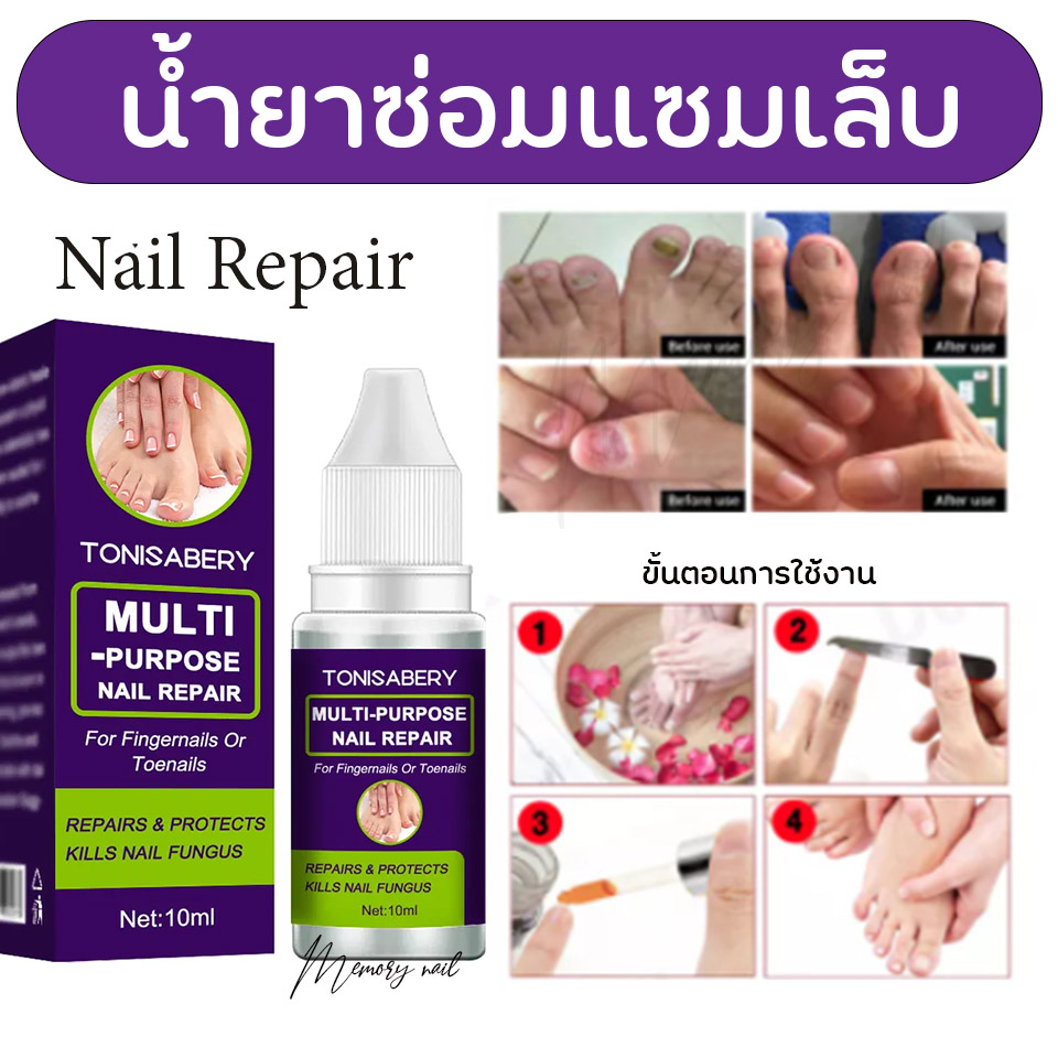 เซรั่มบำรุงเล็บ,น้ำยาบำรุงเล็บ,บำรุงเล็บ,ต่อต้านการติตเชื้อรา,ซ่อมแซมเล็บแตก,เล็บเปราะ,เล็บหนา,น้ำยากันเชื้อราเล็บ,ไล่เชื้อรา,ไล่ความชื้นกันเชื้อรา,ปรับความสมดุลหน้าเล็บ