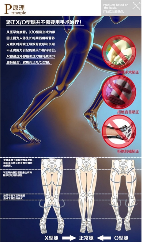 สายรัด แก้ขาโก่ง วิธีแก้ขาโก่งที่ได้ผลดีสุดยอด